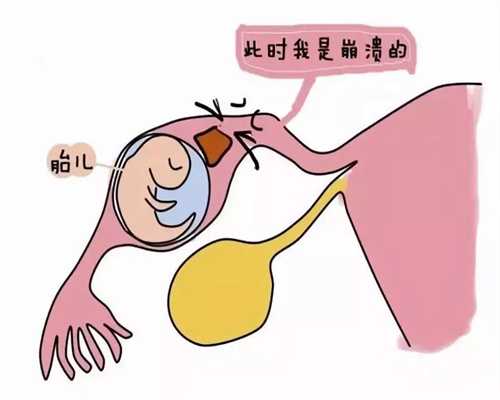 郑州供卵代孕,想找郑州供卵去哪里,3代郑州试管代孕可以选男女吗
